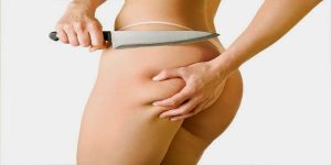 Get Rid of Your Cellulite Faster