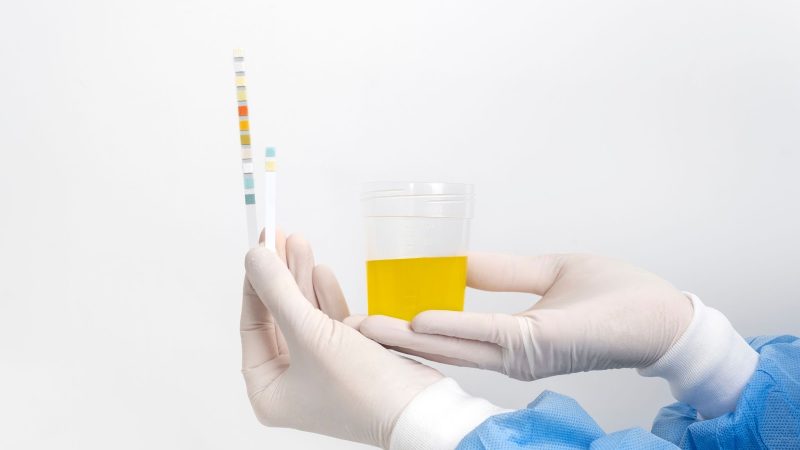 Unveiling the Science Behind Synthetic Urine: Navigating Drug Tests with Confidence